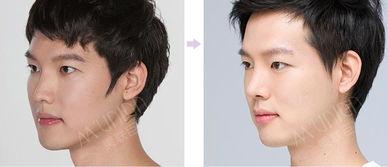 爆料整形鼻子视频大全,鼻子整形视频大全大曝光 第3张 爆料整形鼻子视频大全,鼻子整形视频大全大曝光 第3张